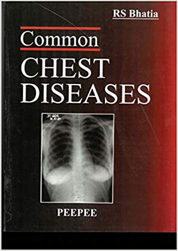 Common Chest Diseases