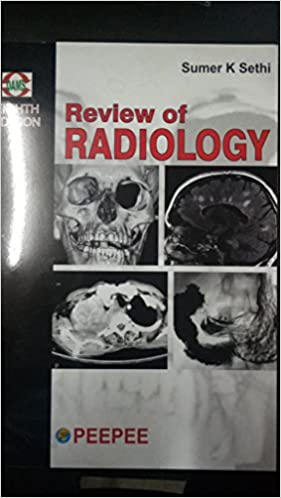 Review Of Radiology, 8/E