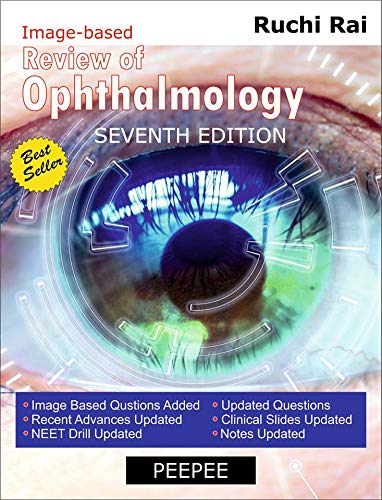 Review Of Ophthalmology 7E