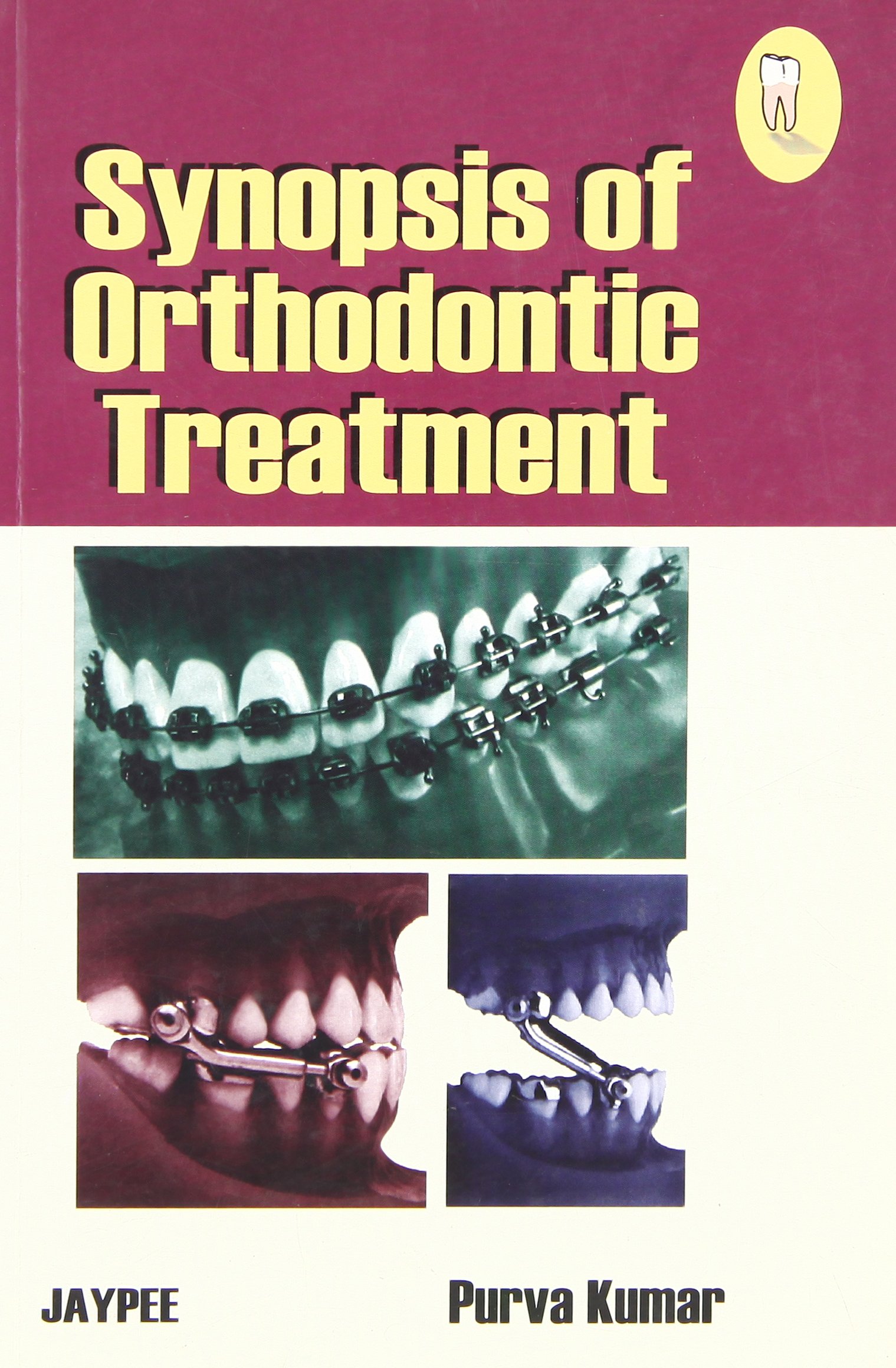 Synopsis Of Orthodontic Treatment