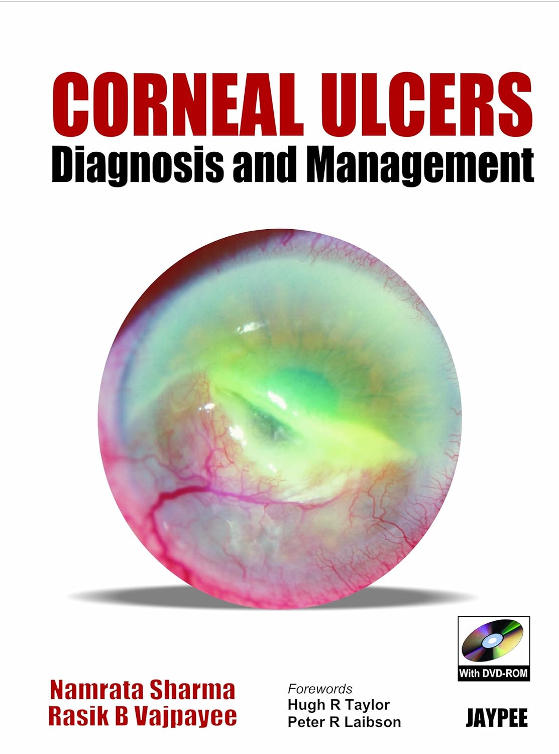 Corneal Ulcers Diagnosis And Management With Dvd-Rom