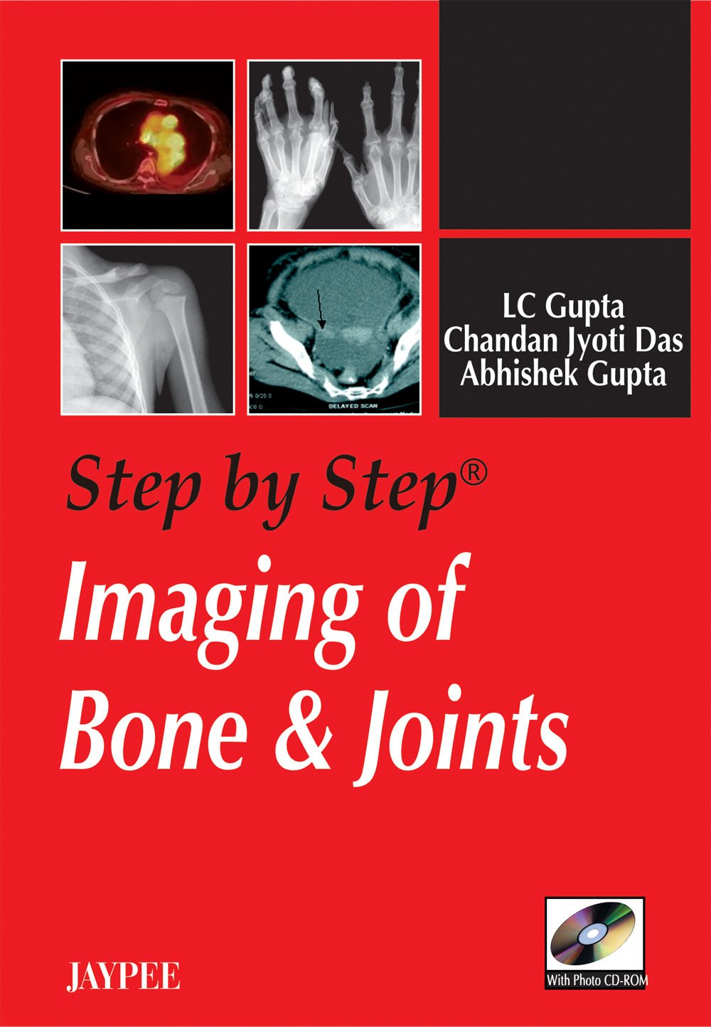 Step By Step Imaging Of Bone & Joints With Photo Cd-Rom