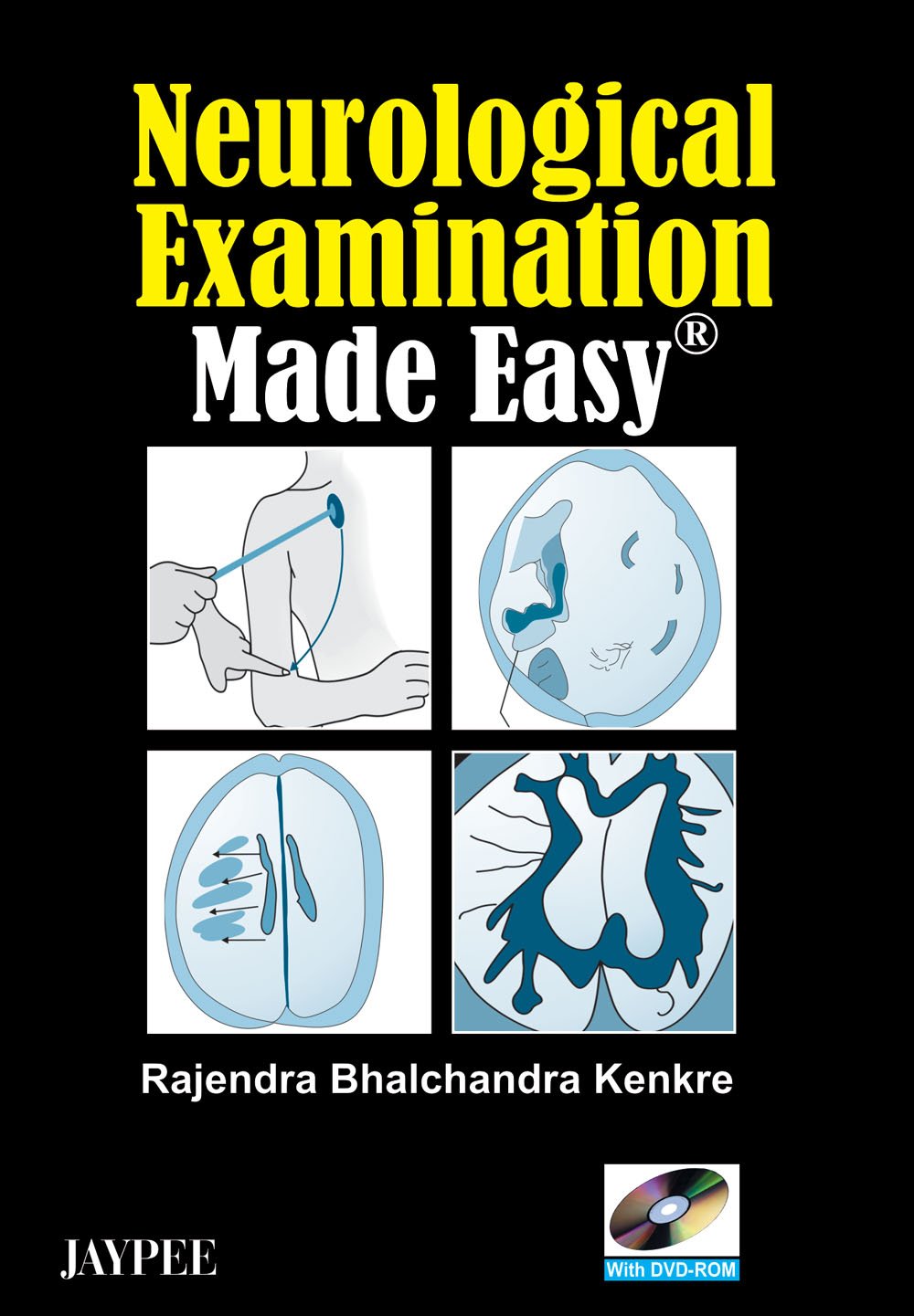 Neurological Examination Made Easy With Dvd-Rom