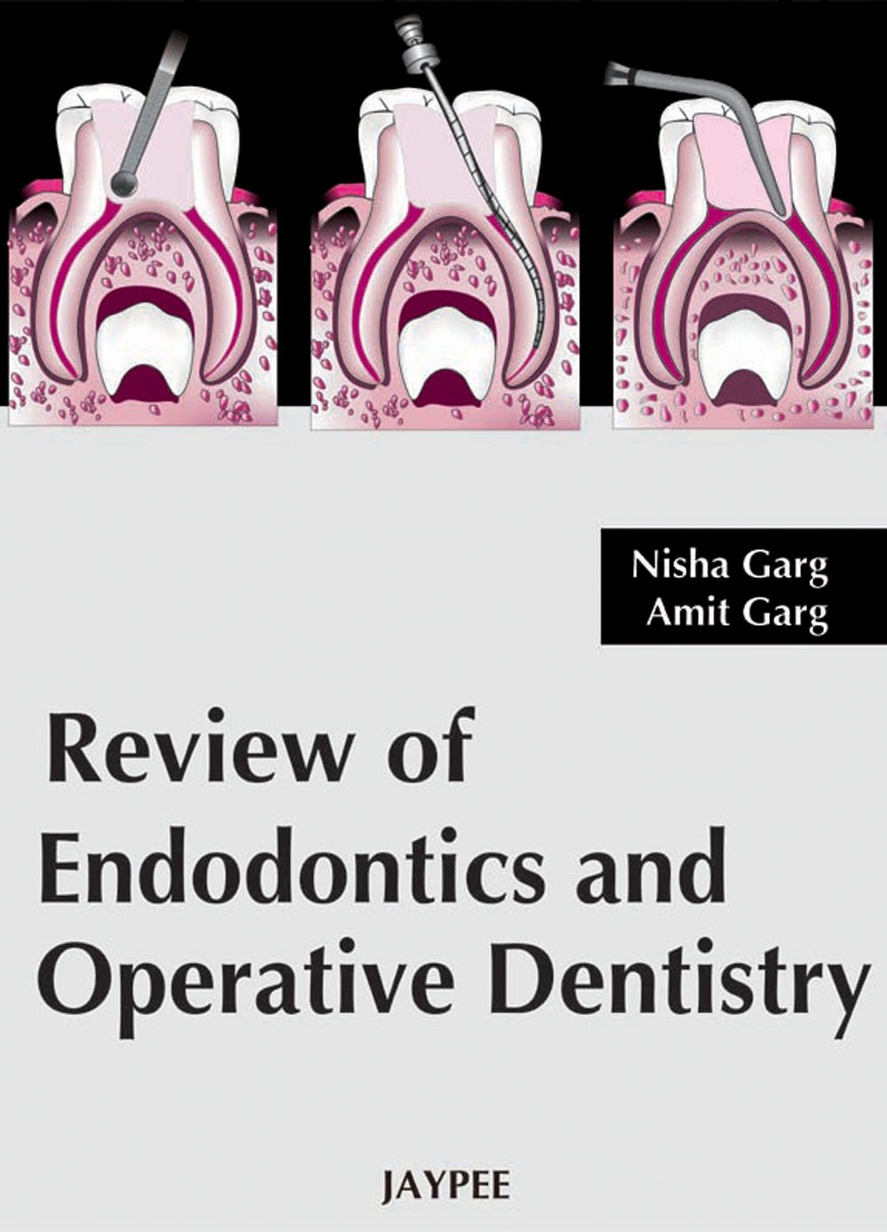 Review Of Endodontics And Operative Dentistry
