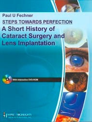 Steps Towards Perfection A Short History Of Cataract Surgery And Lens Implantation