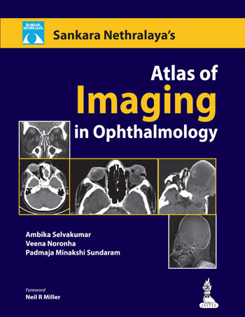 Sankara Nethralaya Atlas Of Imaging In Ophthalmology