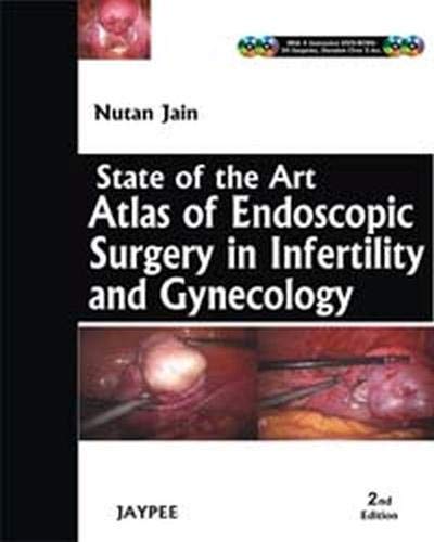 State Of The Art: Atlas And Endoscopy Surgery In Infertility And Gynecology (With 4 Dvd-Roms)