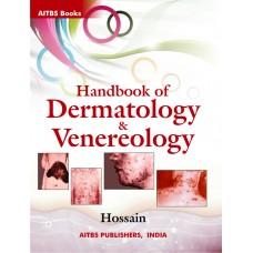 Handbook of Dermatology and Venereology