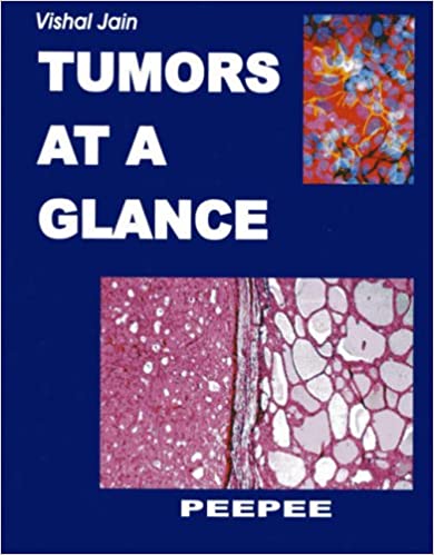 Tumors At A Glance For Dm Oncology
