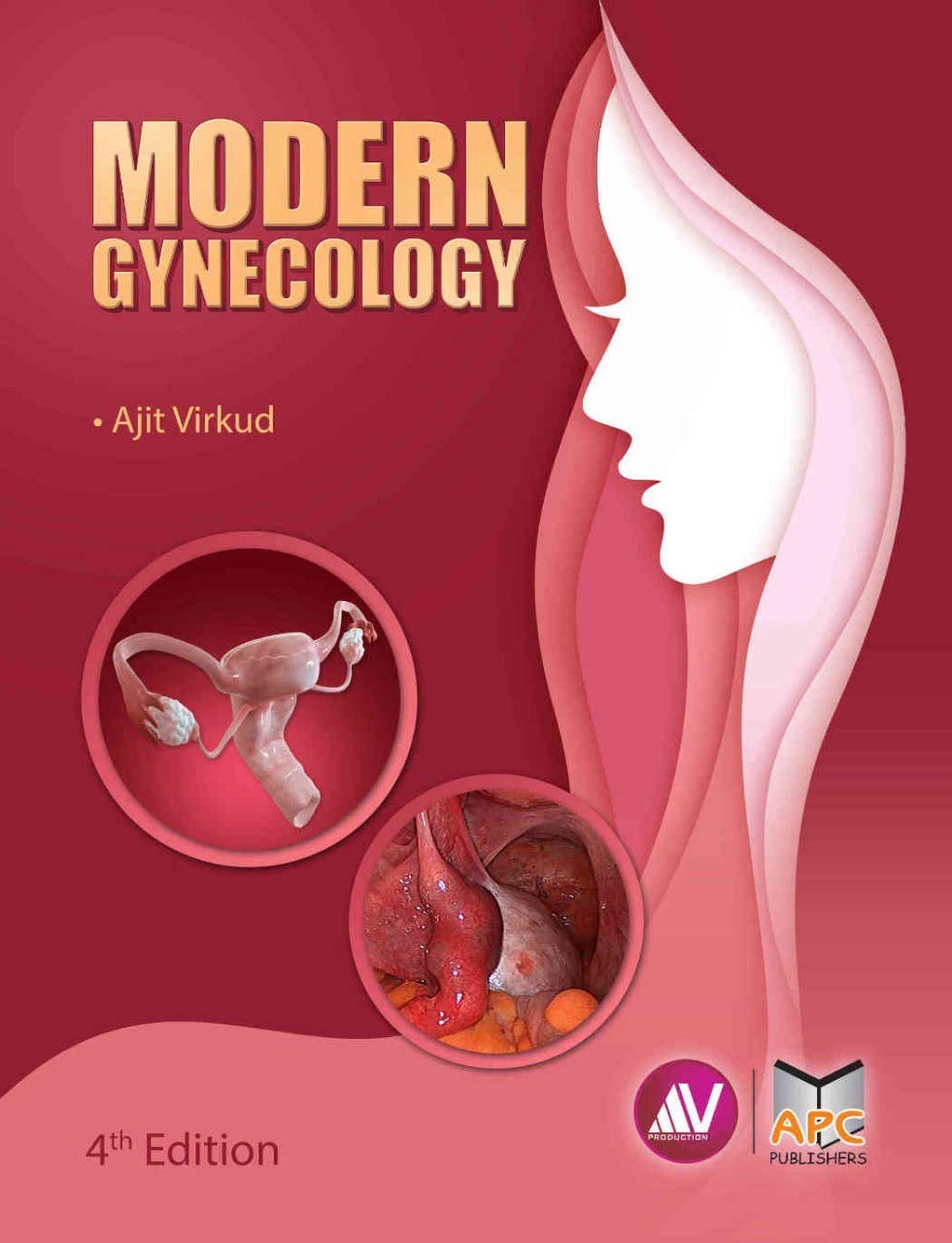 Modern Gynecology 4th Edition