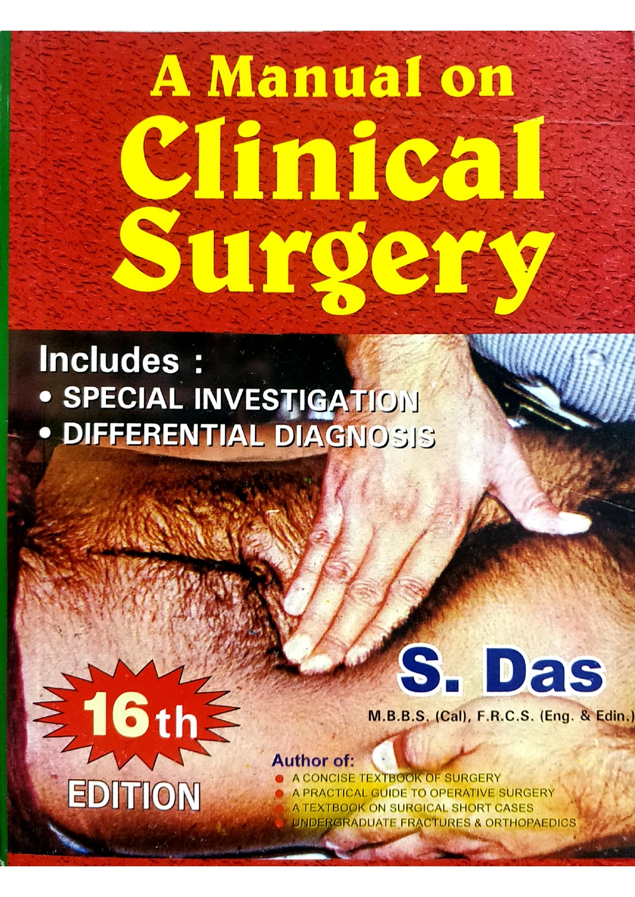 A Manual on Clinical Surgery 16th Edition 2022