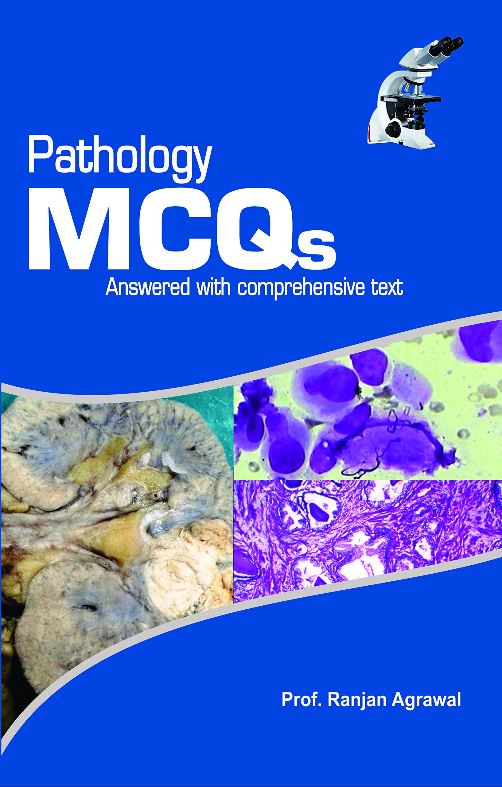 Pathology Mcqs