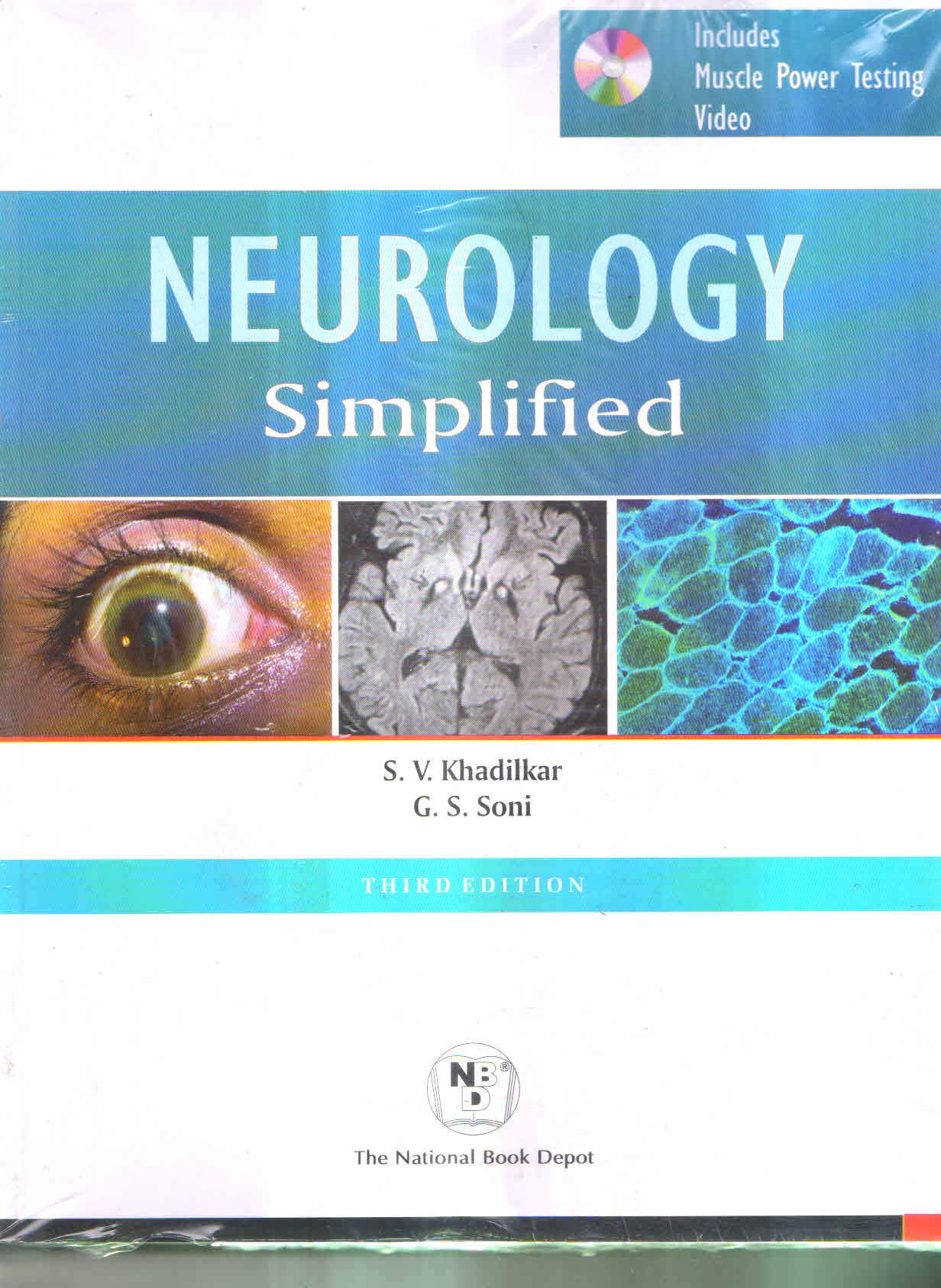 Neurology Simplified, 3E, With Cd (Pb)