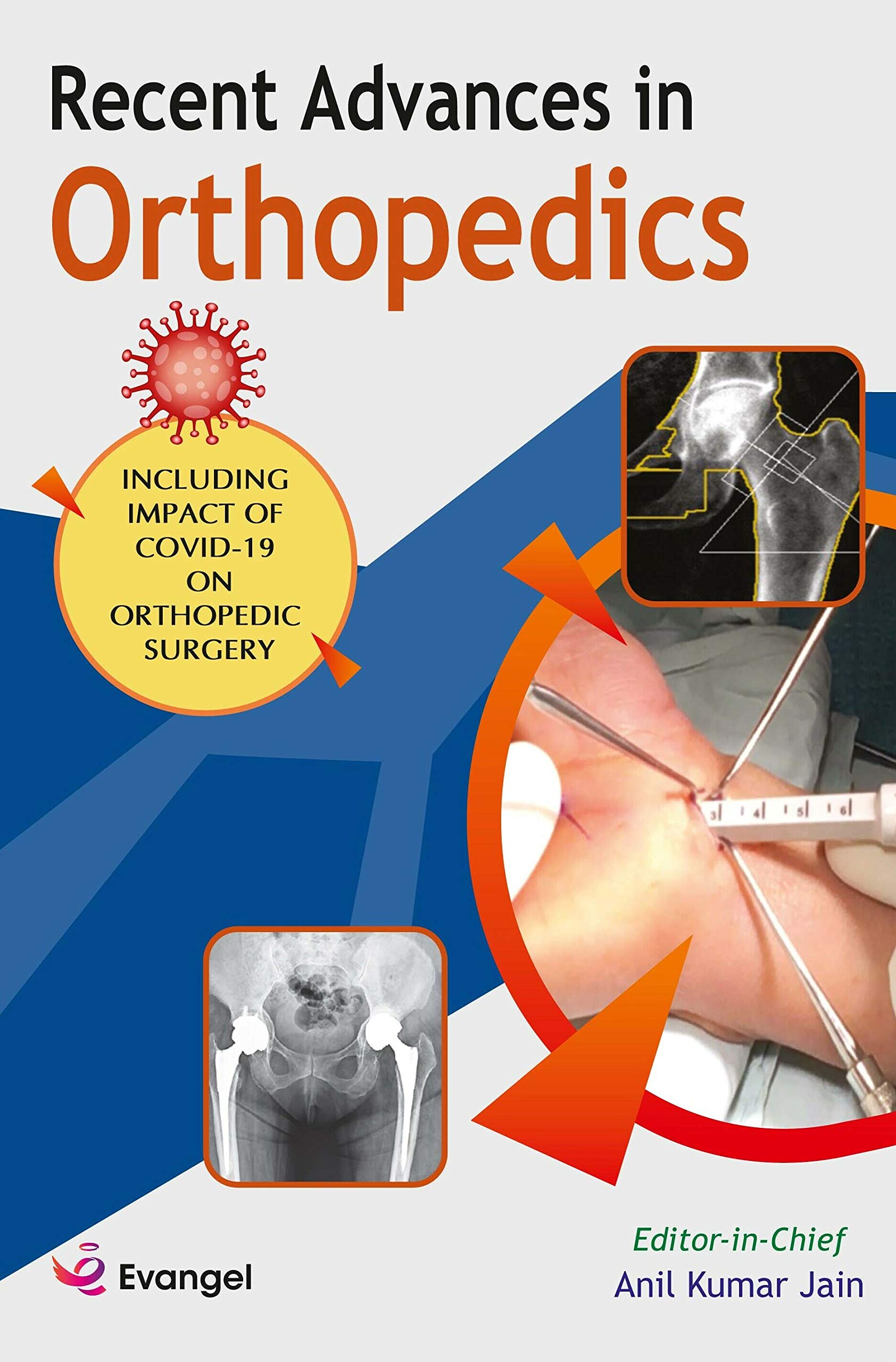 Recent Advances In Orthopedics