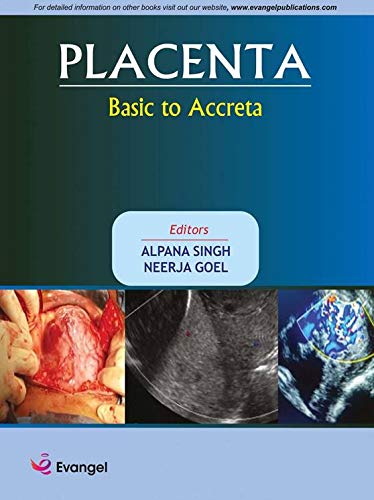 Placenta - Basic To Acrreta