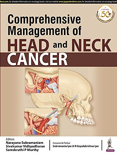 Comprehensive Management Of Head And Neck Cancer