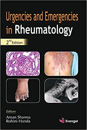 Urgencies and Emergencies in Rheumatology 2nd Ed