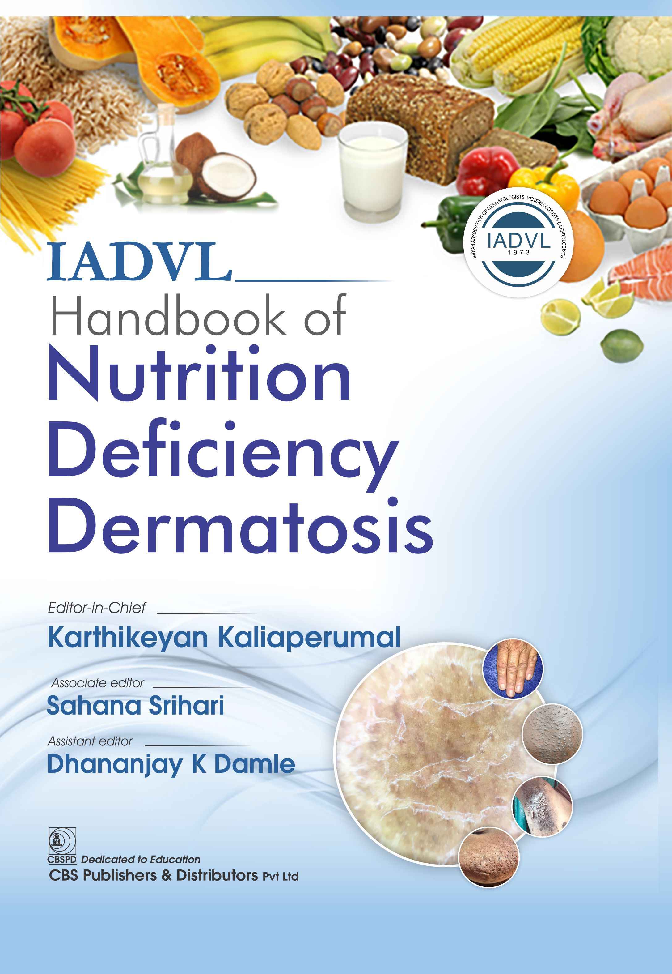 Iadvl Handbook Of Nutrition Deficiency Dermatosis (Hb 2025)