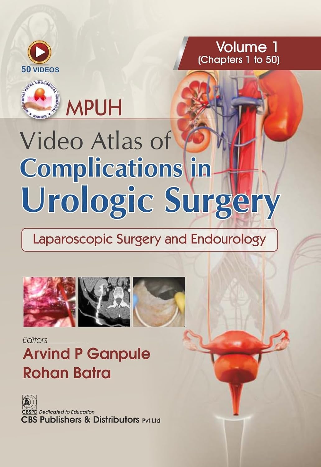 Mpuh Video Atlas Of Complications In Urologic Surgery Laparoscopic Surgery And Endourology Vol 1 Chapters 1 To 50 (Hb 2026)