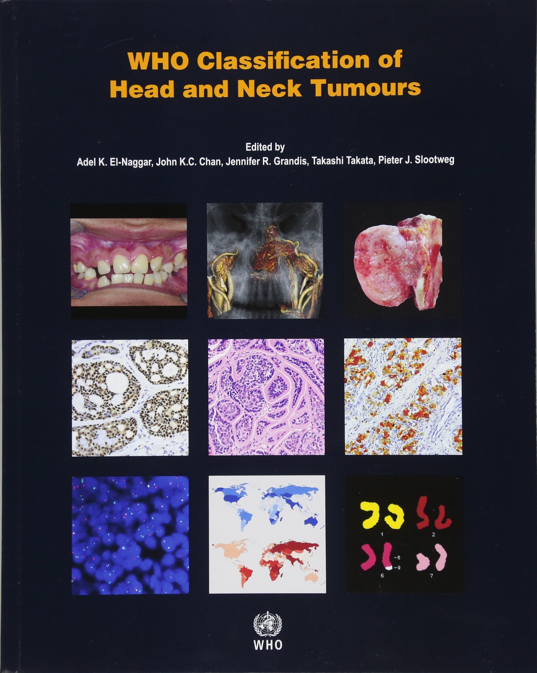 WHO Classification Of Head And Neck Tumours 4/E