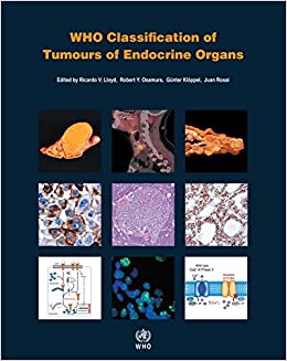 WHO Classification Of Tumours Of Endocrine Organs : 4/E (World Health Organization (WHO) Classification Of Tumours)