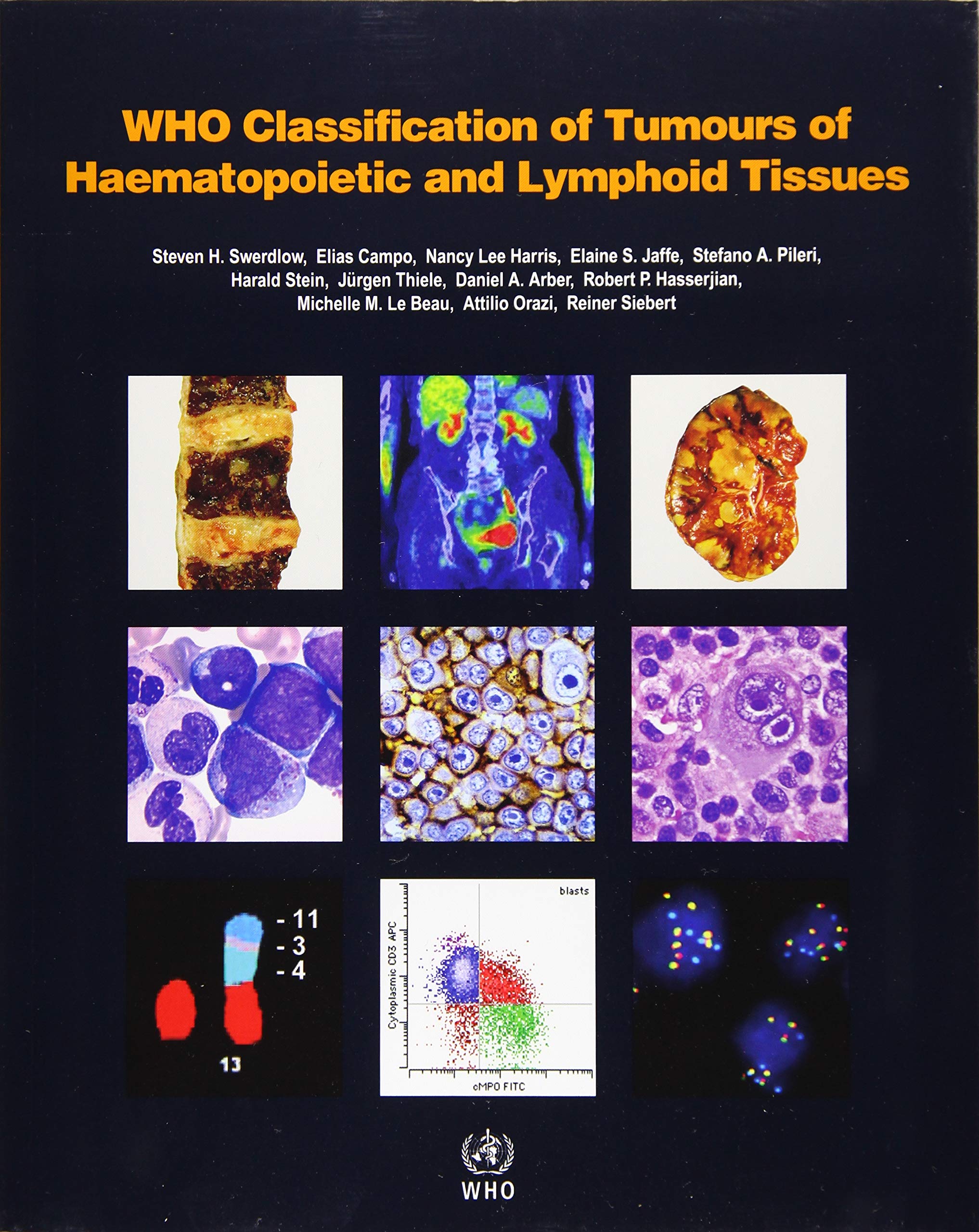 WHO Classification Of Tumours Of Haematopoietic And Lymphoid Tissues: Vol. 2 (World Health Organization (WHO) Classification Of Tumours)