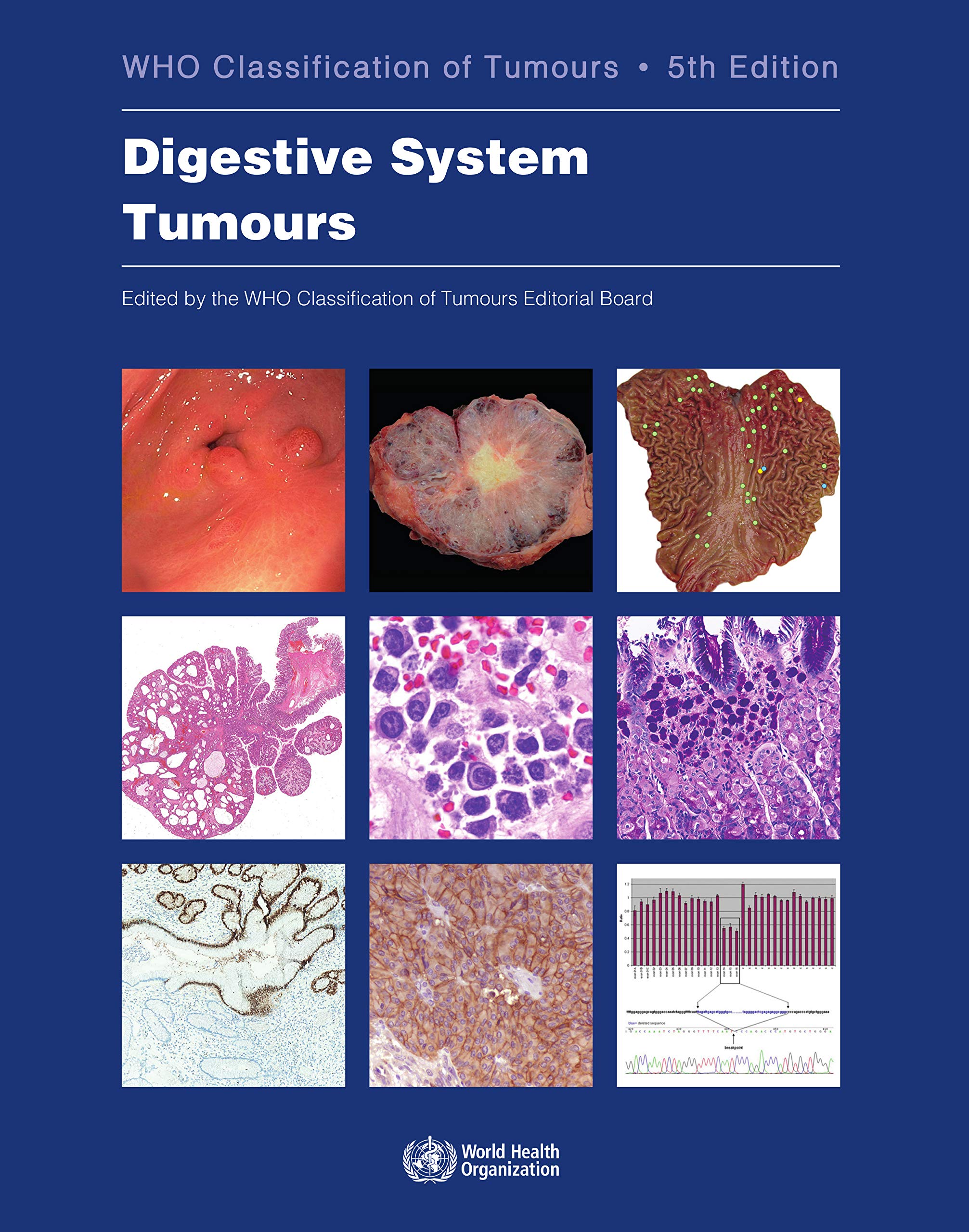 Digestive System Tumours (World Health Organization (WHO) Classification Of Tumours)
