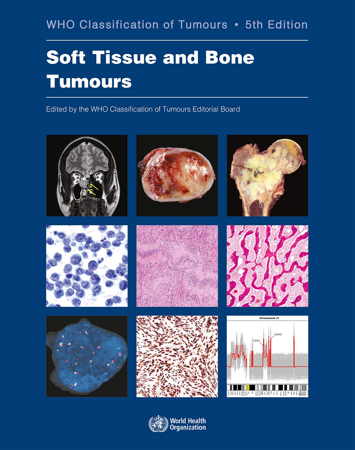 WHO Classification Of Tumours Of Soft Tissue And Bone Tumours  (World Health Organization (WHO) Classification Of Tumours)