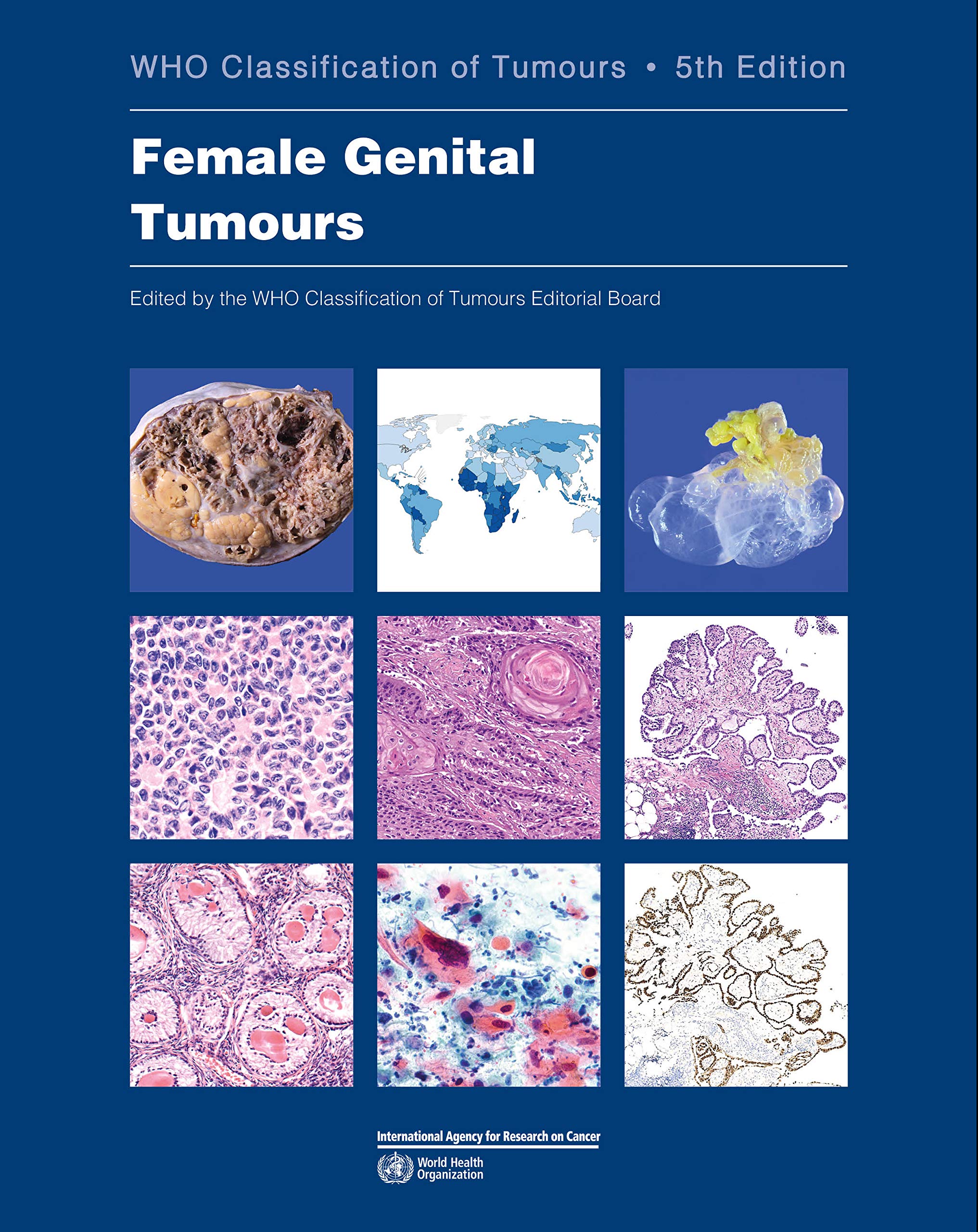 WHO Classification Of Tumours:Female Genital Tumours (World Health Organization (WHO) Classification Of Tumours)