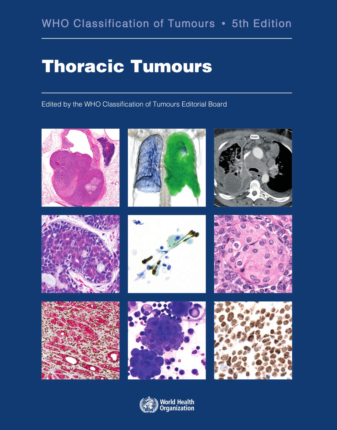 WHO Classification of Tumours, 5th Edition, Volume 5  Thoracic Tumours