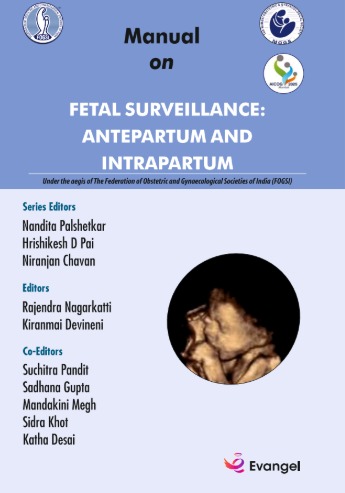 FOGSI Manual on Fetal Surveillance- Antepartum and Intrapartum