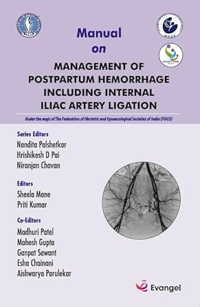 FOGSI Manual on Management in Postpartum Hemorrhage including internal lliac
