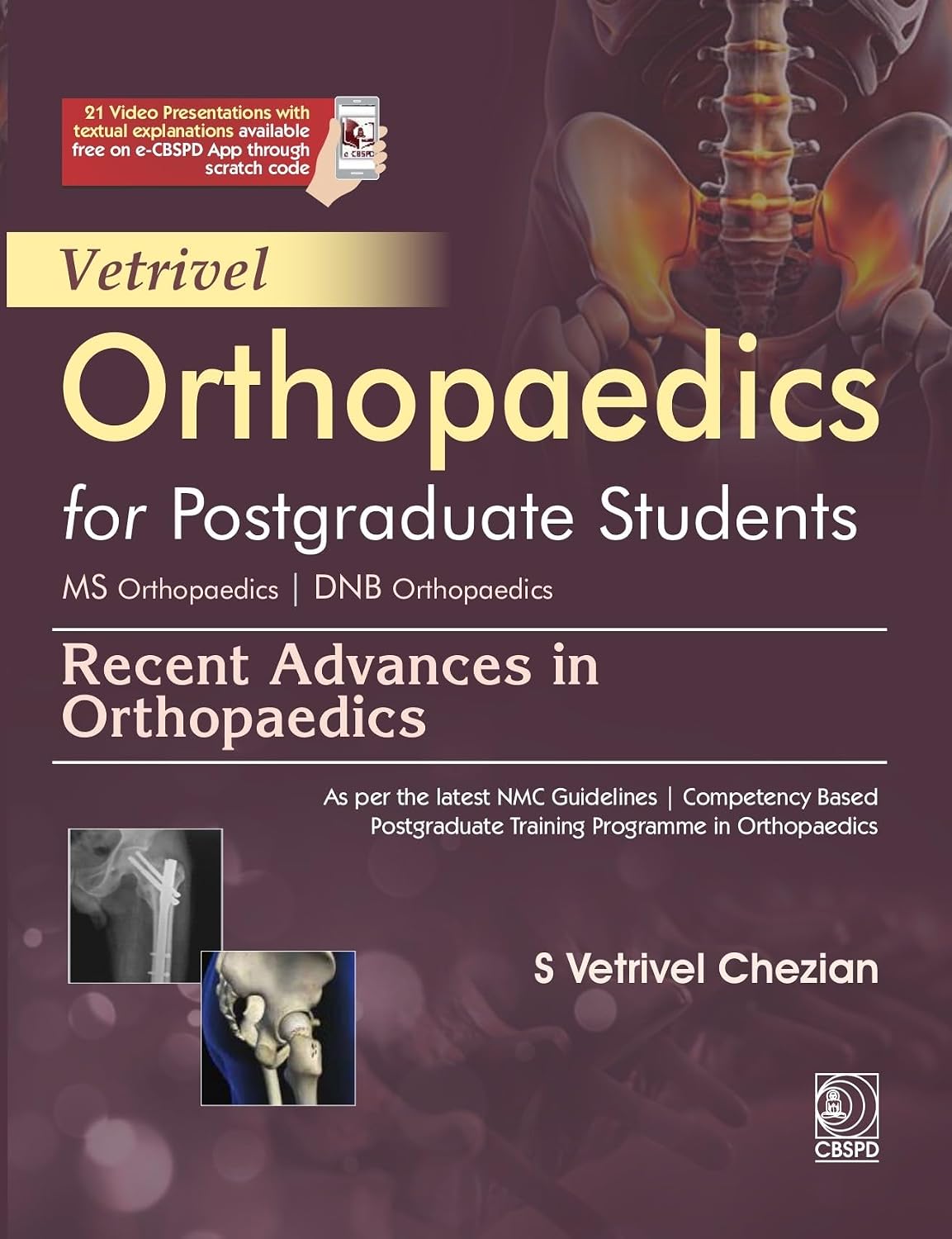 Vetrivel Orthopaedics For Postgraduate Students Ms Orthopaedics Dnb Orthopaedics Recent Advances In Orthopaedics (Pb 2027)