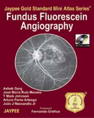 Fundus Fluorescein Angiography Jaypee Gold Standard Mini Atlas Series With Photo Cd-Rom