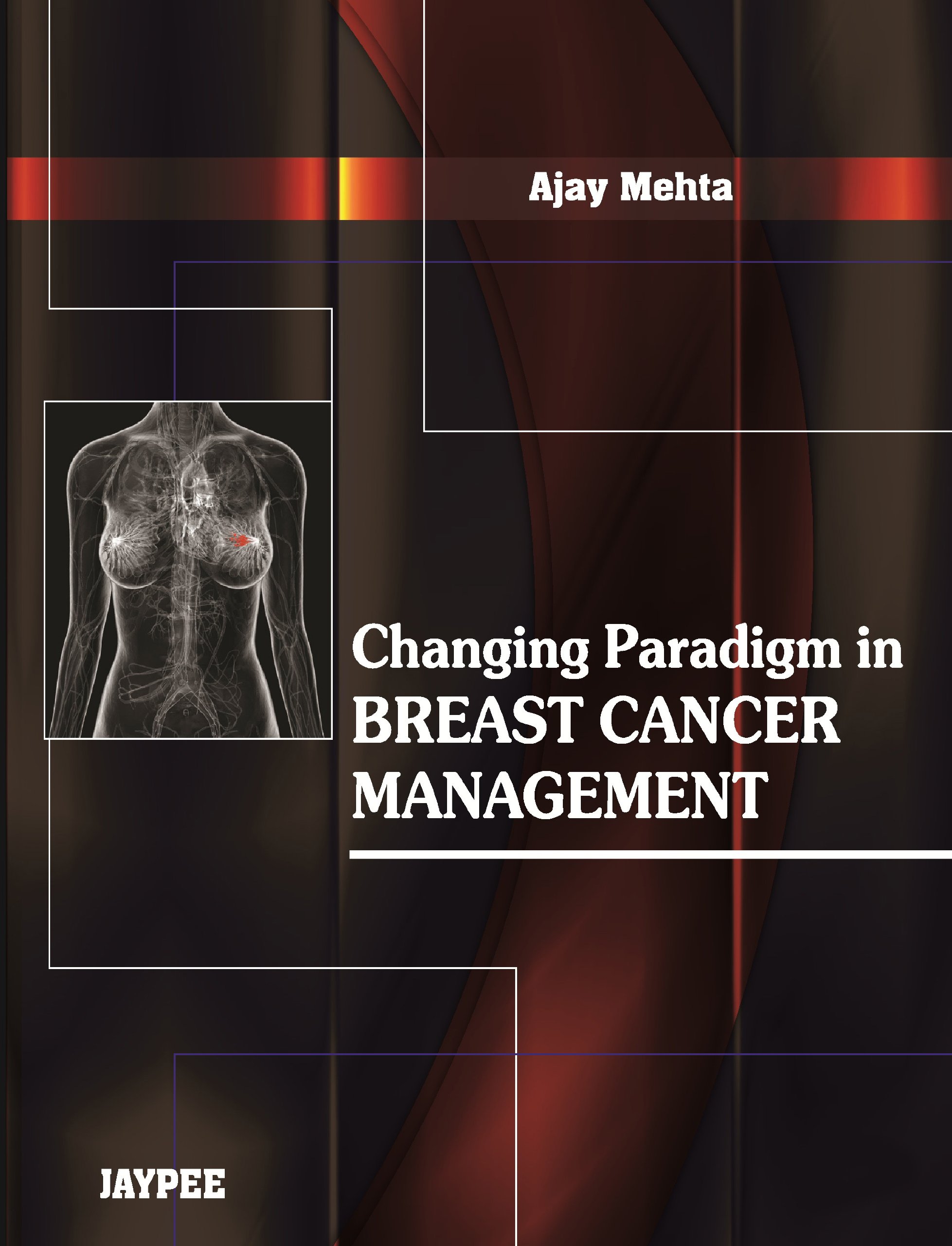 Changing Paradigm In Breast Cancer Management