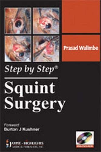 Step By Step Squint Surgery