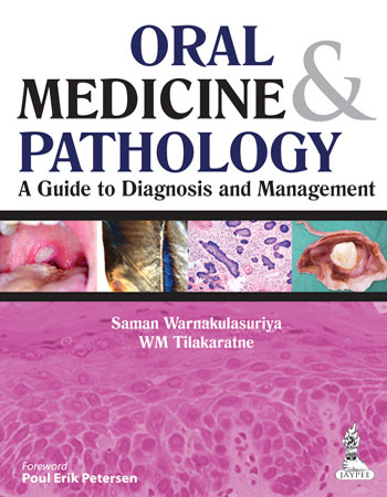 Oral Medicine & Pathology A Guide To Diagnosis And Management