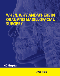 When,Why And Where In Oral And Maxillofacial Surgery