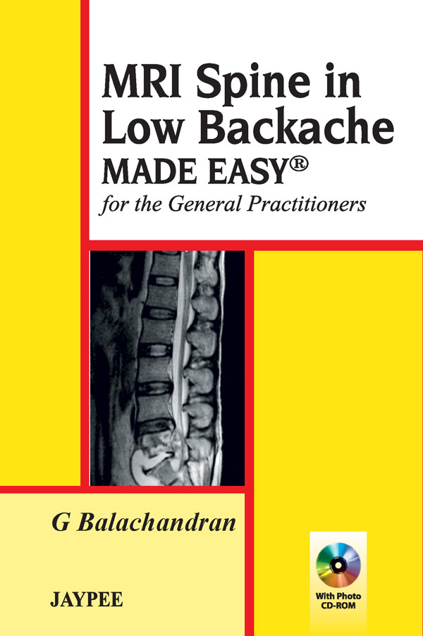 Mri Spine In Low Backache Made Easy For The General Practitioners