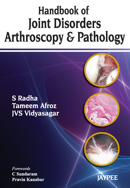 Handbook Of Joint Disorders Arthroscopy & Pathology
