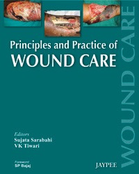 Principles And Practice Of Wound Care