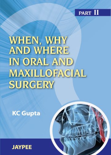 When,Why And Where In Oral And Maxillofacial Surgery Part Ii