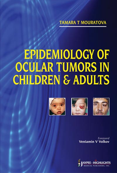 Epidemiology Of Ocular Tumors In Children & Adults