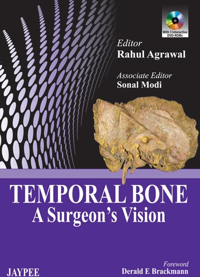 Temporal Bone: A Surgeon'S Vision With Dvd Rom