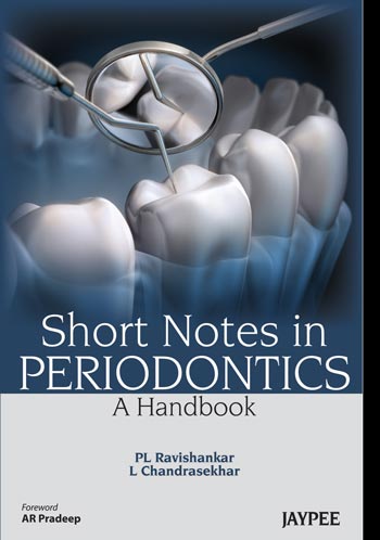 Short Notes In Periodontics A Handbook