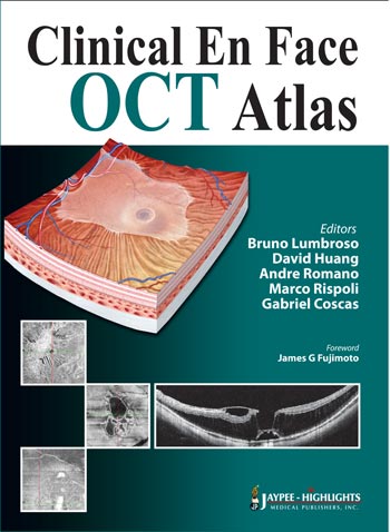 Clinical En Face Oct Atlas
