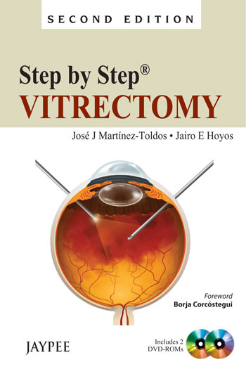 Dr.Hoyos'Step By Step Vitrectomy Inc.2 Dvd-Roms