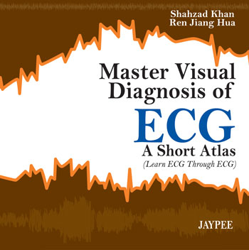 Master Visual Diagnosis Of Ecg A Short Atlas (Learn Ecg Through Ecg)