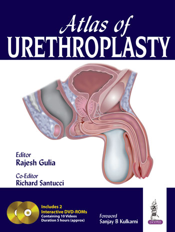 Atlas Of Urethroplasty