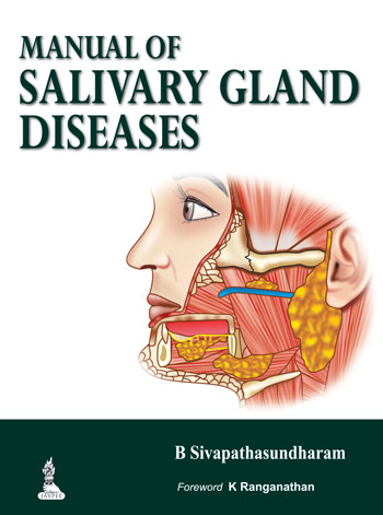 Manual Of Salivary Gland Diseases